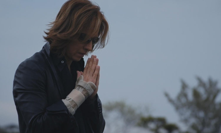 X Japan, Yoshiki recupera dall’intervento